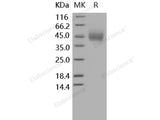 Recombinant Human CD89/FCAR Protein (His Tag)(Active)