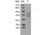 Recombinant Human TRAIL R4/TNFRSF10D Protein (His Tag)(Active)