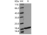 Recombinant Human TRAIL Protein