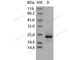 Recombinant Human TRAILR1/TNFRSF10A Protein (His Tag)(Active)