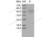 Recombinant Human Kallikrein 1/KLK1 Protein (His Tag)(Active)