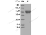 Recombinant Human IL4RA/CD124 Protein (His Tag)(Active)