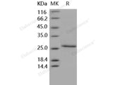 Recombinant Human CD4/LEU3 Protein (aa 1-208, His Tag)(Active)