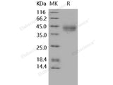 Recombinant Human IL-20RA/IL-20R1 Protein (His Tag)