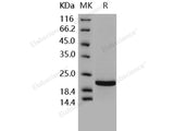 Recombinant Human TIMP2/TIMP-2 Protein (Active)