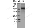 Recombinant Human IL5RA/IL-5 Rα Protein (His Tag)(Active)