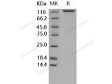 Recombinant Human Contactin 1/CNTN1 Protein (His Tag)(Active)