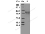 Recombinant Human PD-1/PDCD1 Protein (His Tag)(Active)