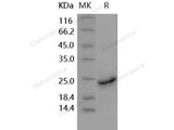 Recombinant Human Sonic Hedgehog/SHH Protein (aa 1-197, His Tag)(Active)