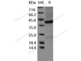 Recombinant Human FRZB/sFRP-3 Protein (His Tag)