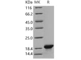 Recombinant Human MOG Protein (aa 30-149, His Tag)