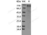 Recombinant Human/Rhesus HER4/ErbB4 Protein (His Tag)(Active)