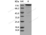 Recombinant Human/Rhesus HER4/ErbB4 Protein (Fc Tag)(Active)