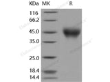 Recombinant Human IFNAR2/IFNABR Protein (His Tag)(Active)