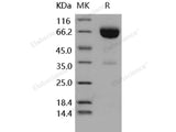 Recombinant Human IFNAR2/IFNABR Protein (Fc Tag)(Active)