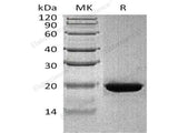 Recombinant Human RBP4 Protein (His Tag)(Active)