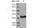 Recombinant Human HSP27/HSPB1 Protein (His Tag)