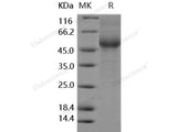 Recombinant Human IL13RA2/CD213A2 Protein (His Tag)(Active)