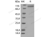 Recombinant Human IL13RA2/CD213A2 Protein (His & Fc Tag)(Active)