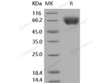 Recombinant Human ICAM-1/CD54 Protein (His Tag)(Active)