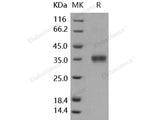 Recombinant Human Granzyme B/GZMB Protein (His Tag)