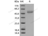 Recombinant Human ICOS/AILIM Protein (His & Fc Tag)(Active)