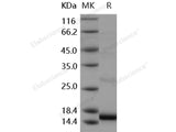 Recombinant Human SLPI Protein (aa 1-132, His Tag)(Active)