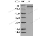 Recombinant Human SLITRK1 Protein (His Tag)