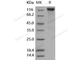 Recombinant Human SLITRK1 Protein (His & Fc Tag)