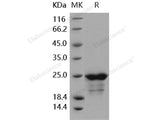 Recombinant Human SMAC/Diablo Protein (His Tag)(Active)