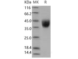 Recombinant Human IFNGR1 Protein (His Tag)(Active)