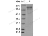 Recombinant Human Iduronate 2-Sulfatase/IDS Protein (His Tag)(Active)