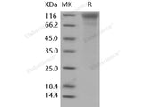 Recombinant Human CD50/ICAM-3 Protein (His Tag)(Active)
