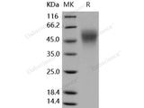 Recombinant Human ICAM-2/CD102 Protein (His Tag)(Active)