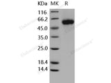 Recombinant Human GFRA1/GDNFRA Protein (aa 1-424, His Tag)(Active)