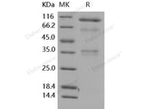 Recombinant Human HGFA Protein (His Tag)