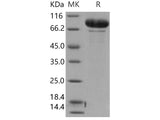 Recombinant Human MMP-9 Protein (Active)