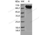 Recombinant Human MMP-9 Protein (His Tag)(Active)