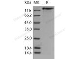 Recombinant Human LEPR/CD295 Protein (His Tag)(Active)