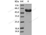 Recombinant Human Fetuin-A/AHSG Protein (His Tag)(Active)