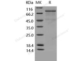 Recombinant Human Cadherin-12/CDH12 Protein (His Tag)