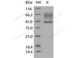 Recombinant Human SerpinA3/AACT Protein (His Tag)(Active)