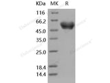 Recombinant Human SerpinA1/A1AT Protein (His Tag)(Active)