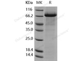 Recombinant Human Coagulation Factor XI/F11 Protein (His Tag)(Active)