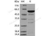 Recombinant Human Galectin-8/LGALS8 Protein (GST Tag)(Active)