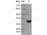 Recombinant Human Galectin-3/LGALS3 Protein, Low Endotoxin(Active)