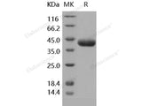 Recombinant Human Prostasin/PRSS8 Protein (His Tag)(Active)