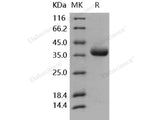 Recombinant Human PRLR/Prolactin Receptor Protein (His Tag)