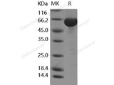 Recombinant Human LTA4H Protein (His Tag)(Active)