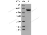 Recombinant Human Osteoprotegerin/TNFRSF11B Protein (His Tag)(Active)